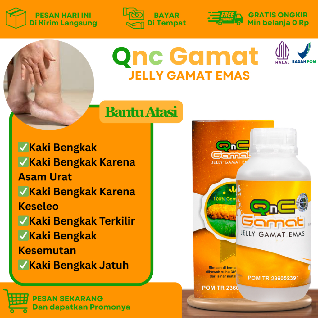 Obat Untuk Kaki Bengkak, Kaki Bengkak Terkilir, Keseleo, Bengkak Karena Jatuh, Kaki Bengkak Karena A