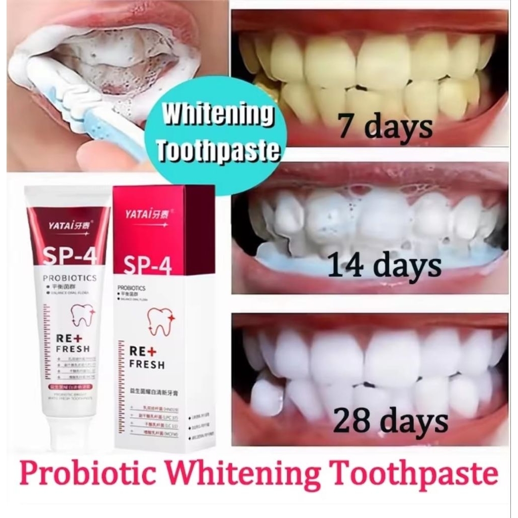 Pasta Gigi Probiotik SP-4 (Whitening/Gigi Putih), Pasta Gigi Pemutih/Odol Pemutih Gigi dan Karang Gi