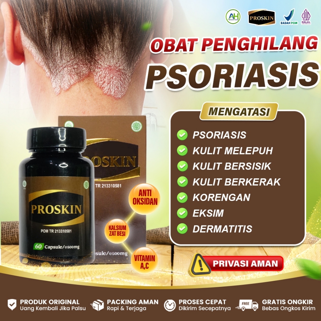 Obat Psoriasis, Psoriasis Kulit Kepala, Penyakit Kulit Psoriasis, Psoriasis Vulgaris, Psoriasis Mena