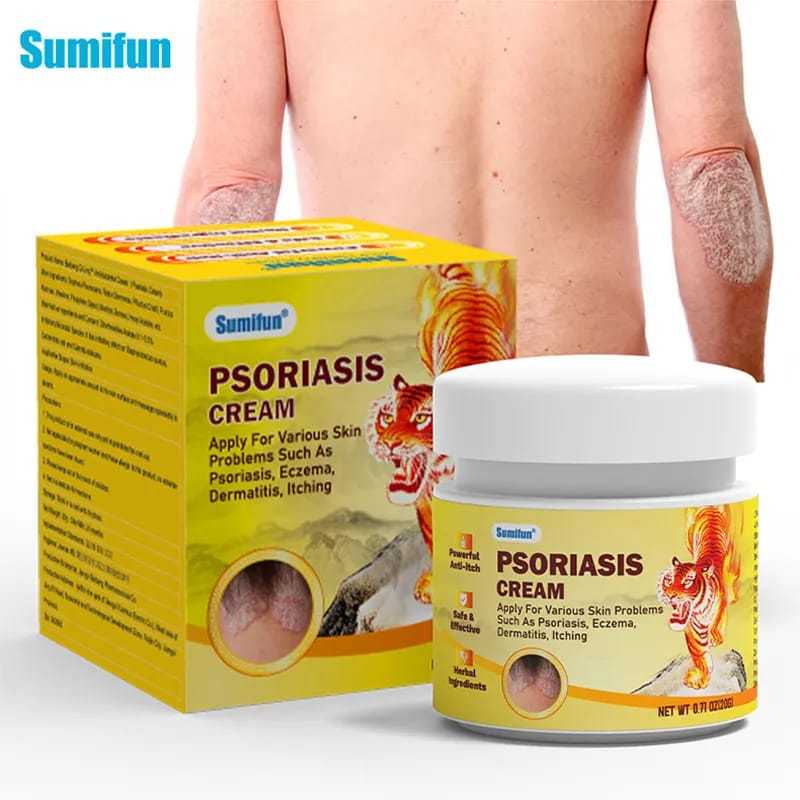 salep jamur kulit salep eksim  RACIKAN JEPANG salep gatal paling ampuh salep gatal 20g Kulit Kepala 