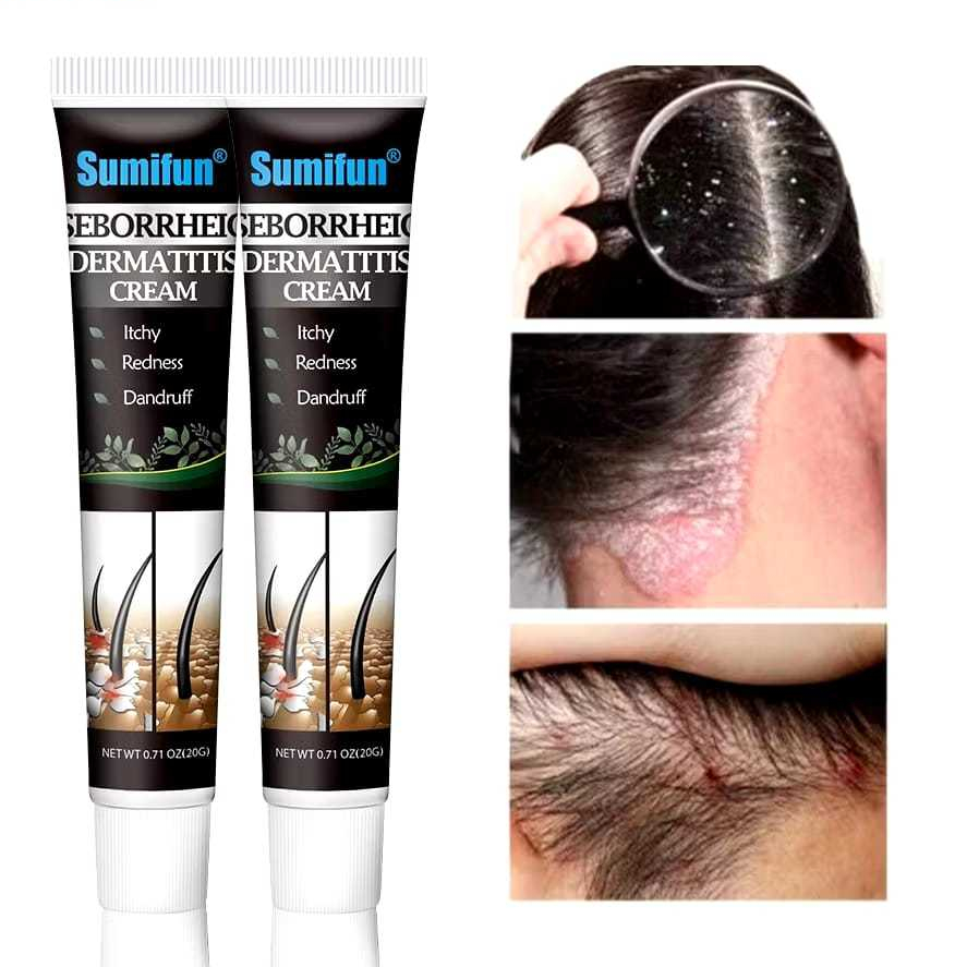 250 Skin Barrier Repair Cream for Seborrheic Dermatitis & Psoriasis