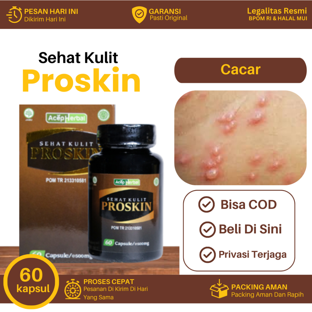 Obat Untuk Cacar, Cacar Bernanah, Cacar Bisul, Cacar Gatal Bintik Api, Penghilang Bekas Cacar Lama -