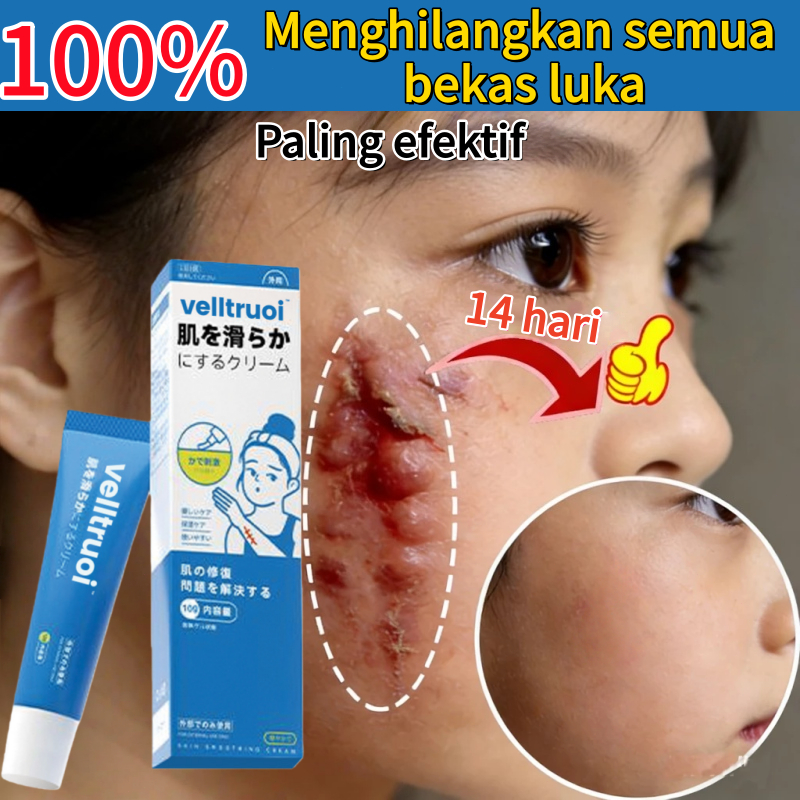 Salep penghilang bekas luka Menghilangkan bekas luka menghitam Salep keloid Cream penghilang bekas l
