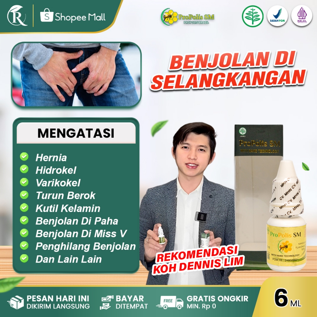 PROPOLIS SM Obat Benjolan Di Selangkangan Paha Herbal Penghilang Benjolan Di Kemaluan Pria Dan Wanit