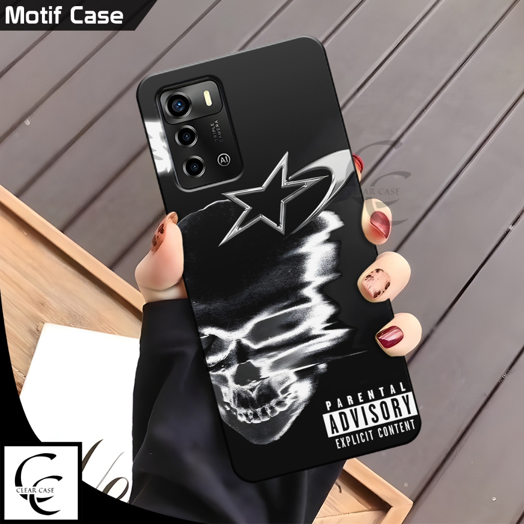 Softcase ZTE Blade A72 & ZTE Blade V40 Vita Terbaru 2026 Silikon Casing Pelindung Hp karet lentur Ca