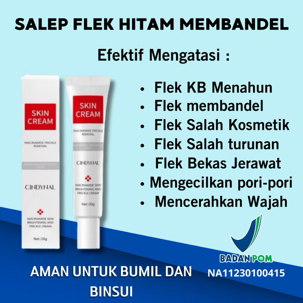 CINDYNAL Skin Cream Freckle Removal Brightening Krim Pemutih Wajah  Whitening Remove Dark Spots Anti