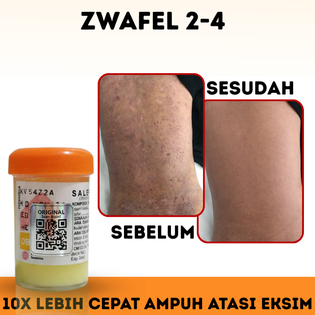 Salep Zwafel 2-4 Original BPOM Obat Gatal Buduk & Scabies Salep 24 Selangkangan Eksim Panu Kadas QR