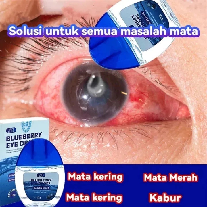 Obat Mata Minus /Tetes Mata Minus/ Katarak/ Silinder/Obat tetes mata obat mata minus obat mata katar