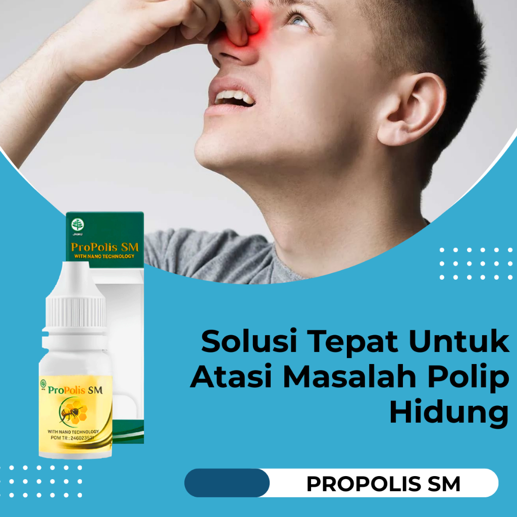 Obat Polip Hidung Obat Sinusitis Rhinitis Konka Hidung Obat Infeksi Hidung - Propolis SM