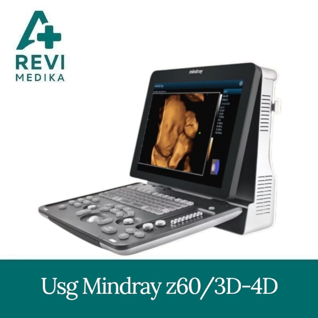 USG MINDRAY Z60 EXP / 3D-4D / DIAGNOSTIC ULTRA SOUND SYSTEM