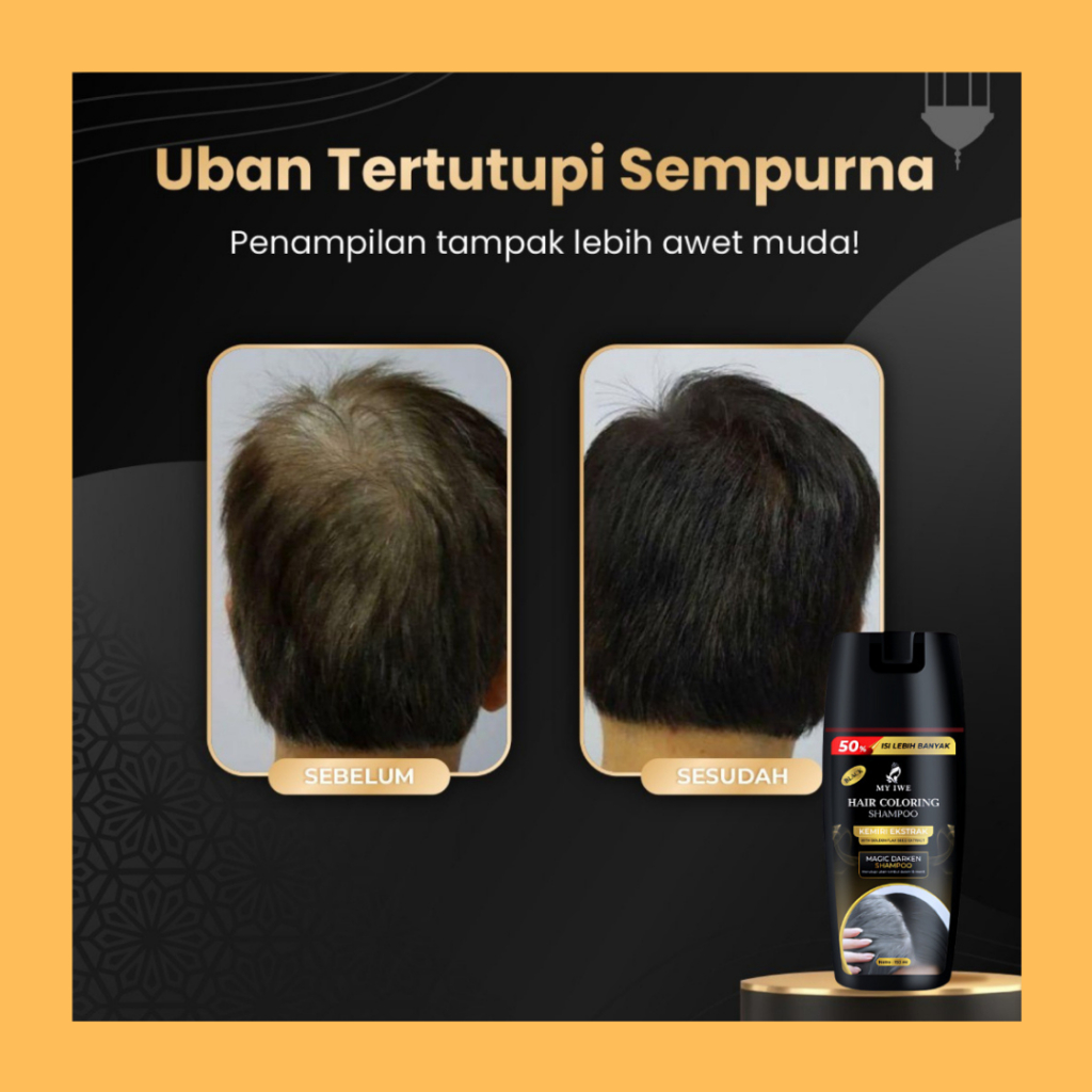 Shampo Penghilang Uban Shampo Penutup Uban Shampo Penghitam uban Myiwe Shampo Penutup uban hilangkan