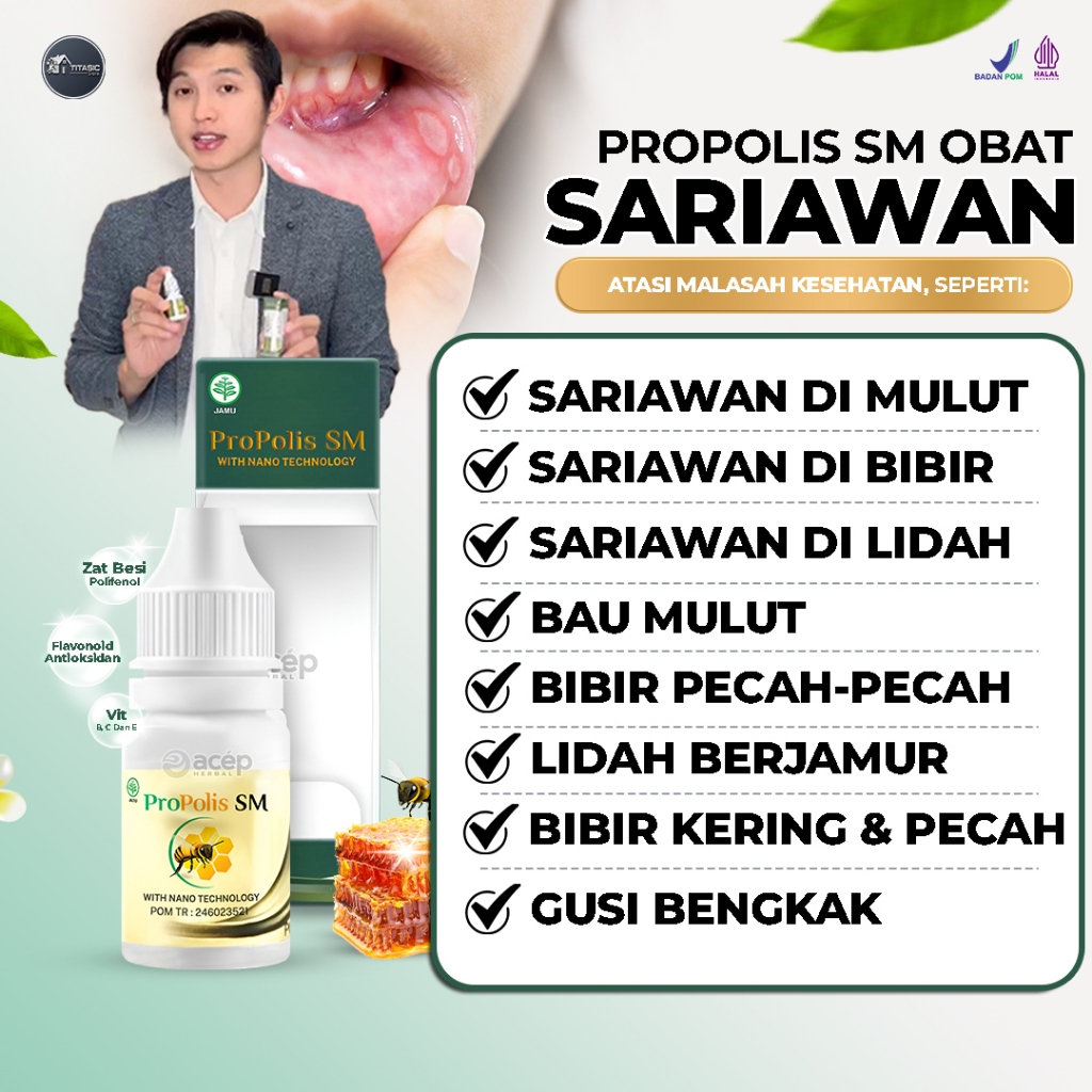 Obat Sariawan Di Bibir Dan Lidah Atasi Bau Mulut Bibir Kering Dan Pecah Pecah Panas Dalam Lidah Berj
