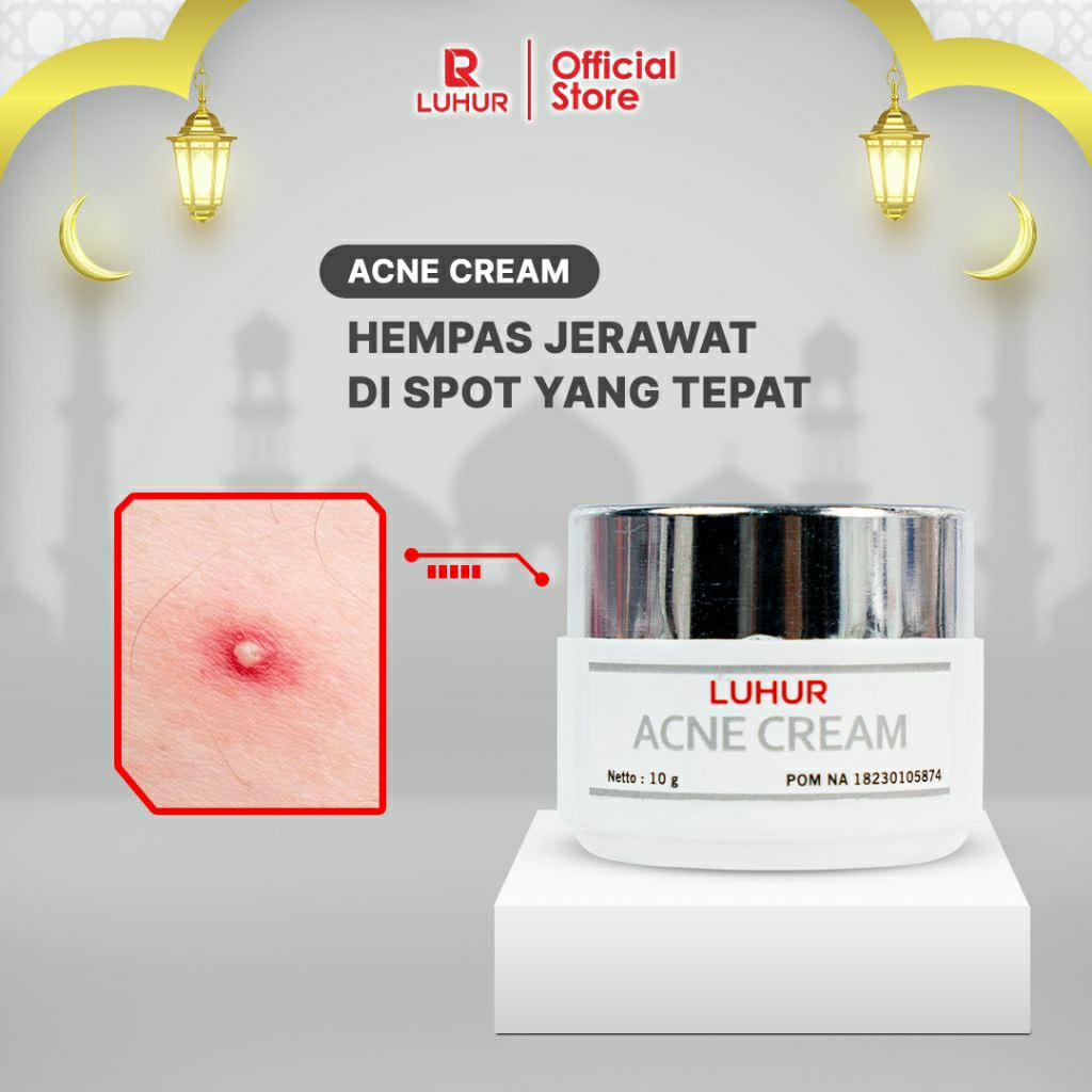Acne  Cream by Luhur  Skincare Cream Totol Jerawat Parah Meradang Bpom