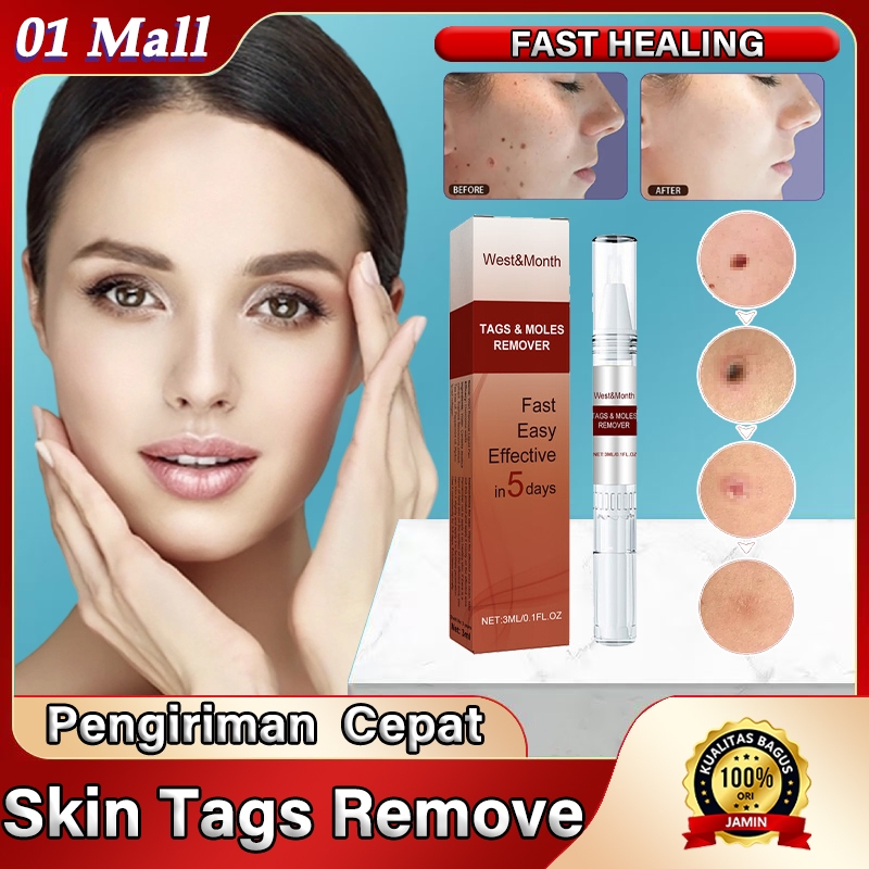 Obat Kutil Paling Ampuh Penghilang Kutil Obat Kutil Kelamin Obat Kutil Di Leher Wipeoff Penghilang K