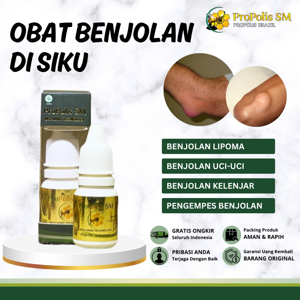 Obat Benjolan Siku, Obat Benjolan Siku Tangan Kanan Kiri, Obat Penghilang Benjolan, Obat Benjolan Li