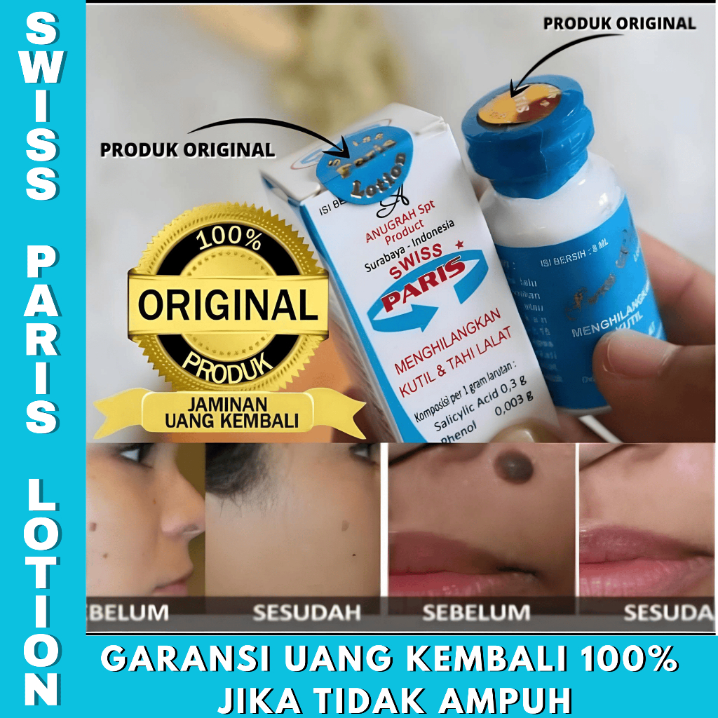 [Garansi Original] Lotion Obat Penghilang Tahi Lalat Di Wajah SWISS PARIS LOTION PENGHILANG KUTIL 8 