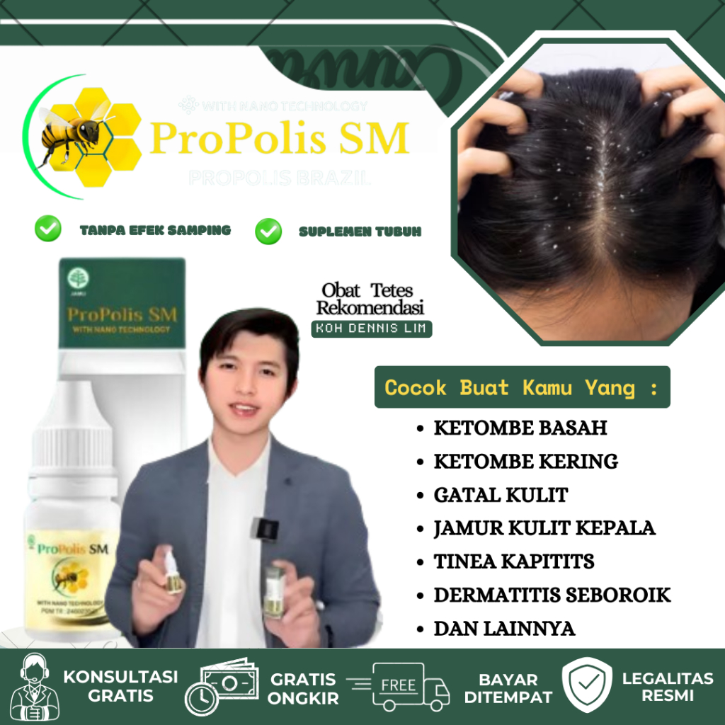 Obat Tetes Ketombe Basah Kering Penghilang Gatal Kulit Kepala Akibat Jamur Kulit Kepala Tinea Kapiti