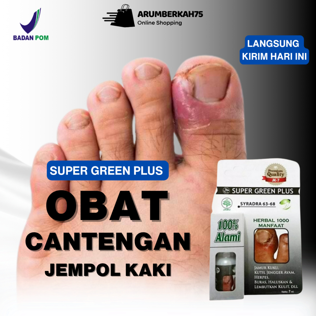 OBAT CANTENGAN JEMPOL KAKI / OBAT KUKU RUSAK / OBAT JAMUR KUKU KAKI / OBAT KUKU JAMUR DAN RUSAK