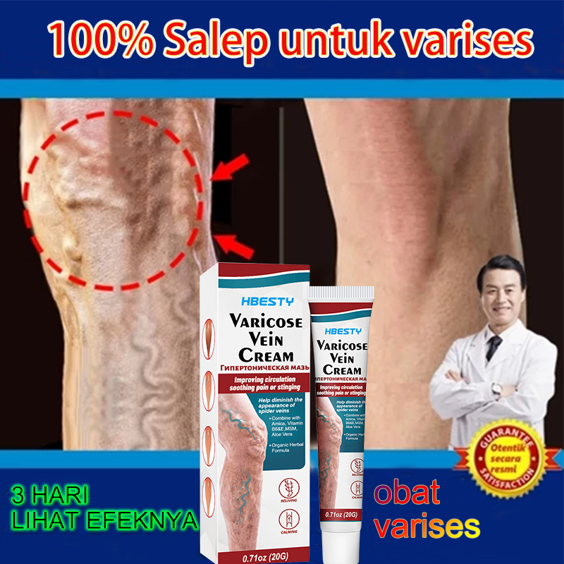 100% Asli Obat Varises Asli 20g Salep Penghilang Varises Ampuh Obat Varises Original Obat Varises Di