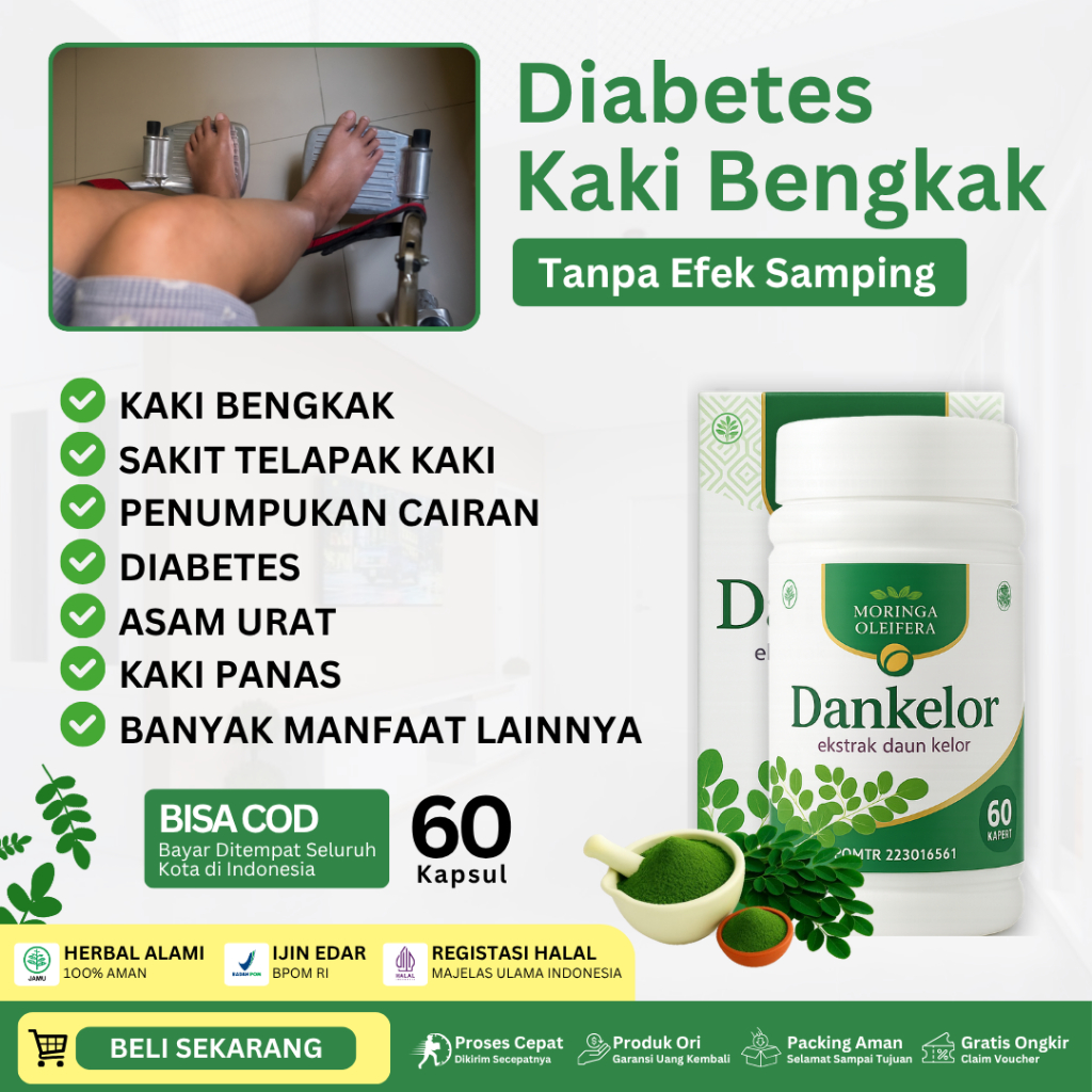 Obat Kaki Bengkak Kaki Bengkak Diabetes Saraf Penyumbatan Darah Ginjal Jantung Liver Terkilir Asam U