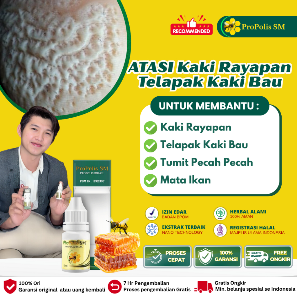 Obat Telapak kaki Rayapan bau dan Rorombeheun korodok, Obat Oles Telapak Kaki Berlubang Bau, Obat Ka