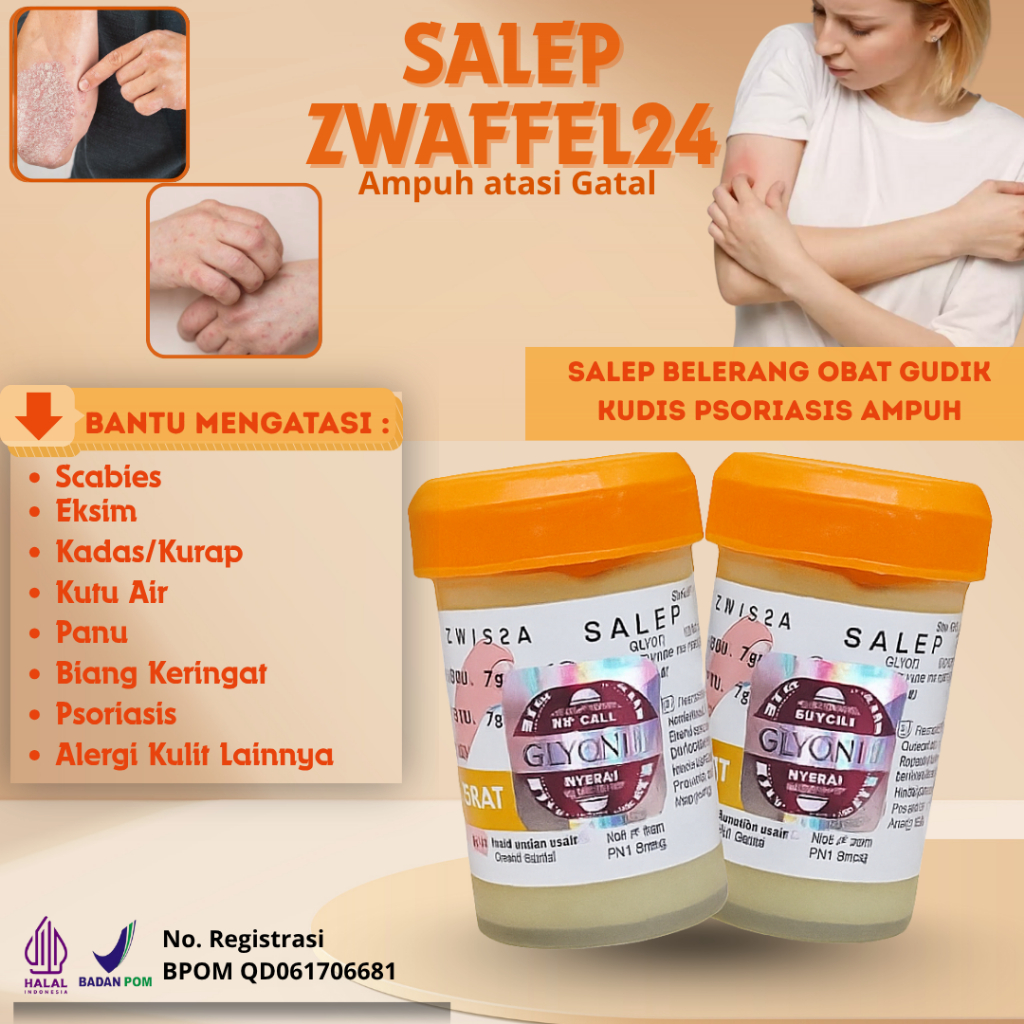 Zwafel 24 Itchy 234 Salep Belerang Obat Gudik Kudis Psoriasis Ampuh