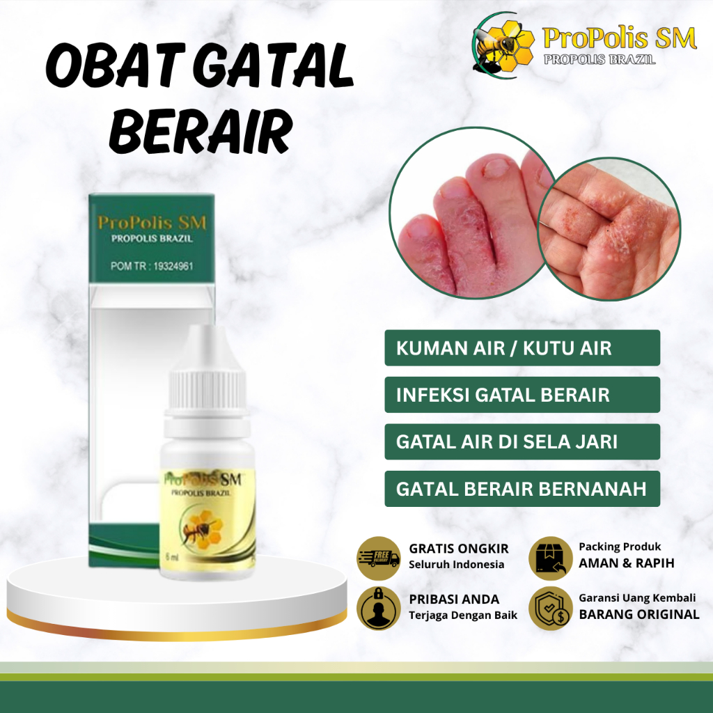 Obat Gatal Berair, Obat Kuman Air, Obat Kutu Air, Obat Bintik Berair, Obat Gatal Berair Menyebar, Ob