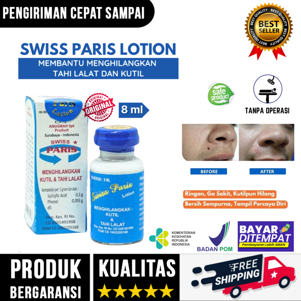 [ COD ] Salep Penghilang Tahi Lalat Dan Kutil Leher Papiloma Swiss Paris Lotion Original Tanpa Efek 