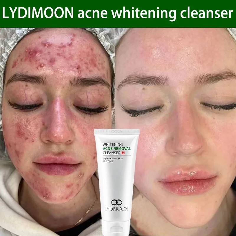 Pembersih Wajah Pemutih Wajah Acnes Facial Wash / Pemutih Wajah100g Kulit Bebas Kusam Brightening Sa