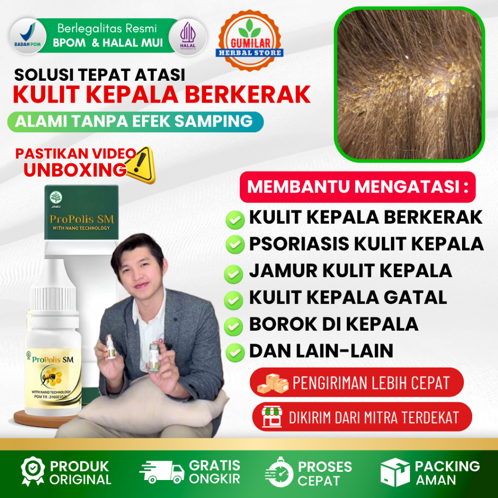 Obat Tetes Kulit Kepala Berkerak Kering Bersisik, Gatal, Psoriasis, Obat Kulit Kepala Anti Gatal (BP