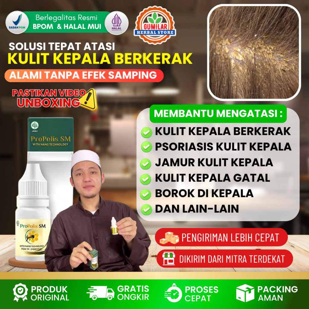 [COD] Obat Oles Tetes Kulit Kepala Berkerak Kering Bersisik, Gatal, Obat Psoriasis Kulit Kepala, Oba