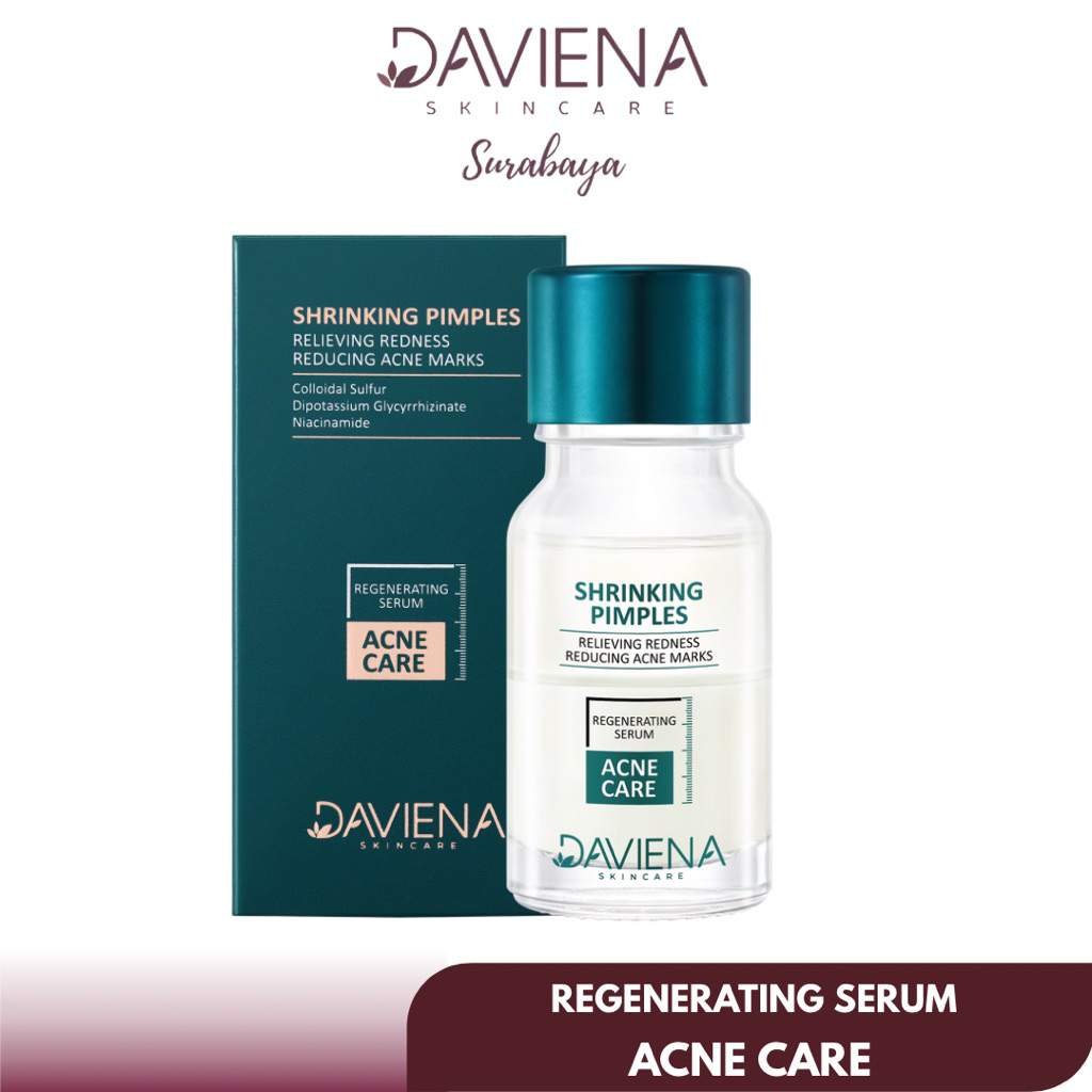 ACNE CARE REGENERATING SERUM || DAVIENASKINCARE || DAVIENA SKINCARE || DAVINA