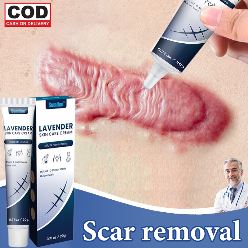 Penghilang bekas luka Scar Remover Cream 20g penghilang bekas luka keloid salep Lama Hitam Koreng Sa