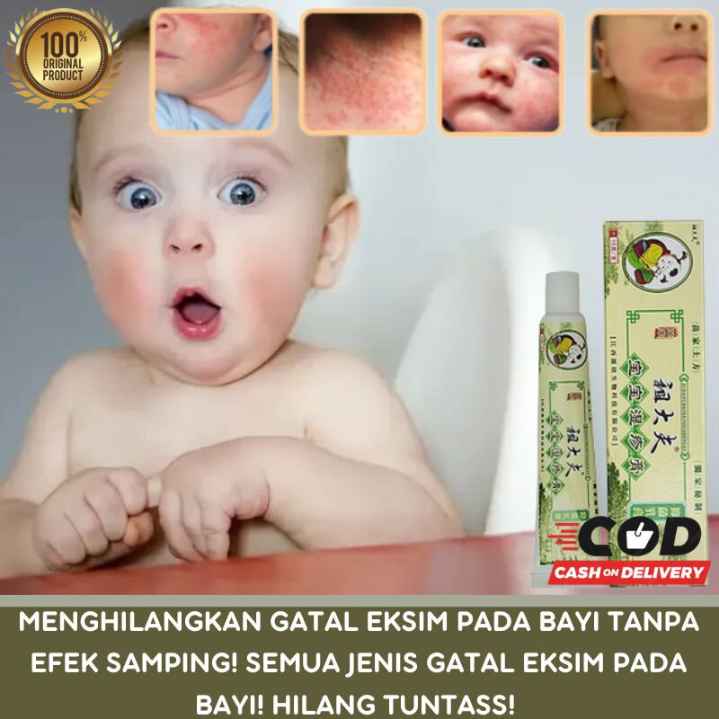 CREAM SALEP BAYI ANAK GIGIT NYAMUK RUAM RUAM IRITASI BIANG KERINGAT ZUDIAFUU
