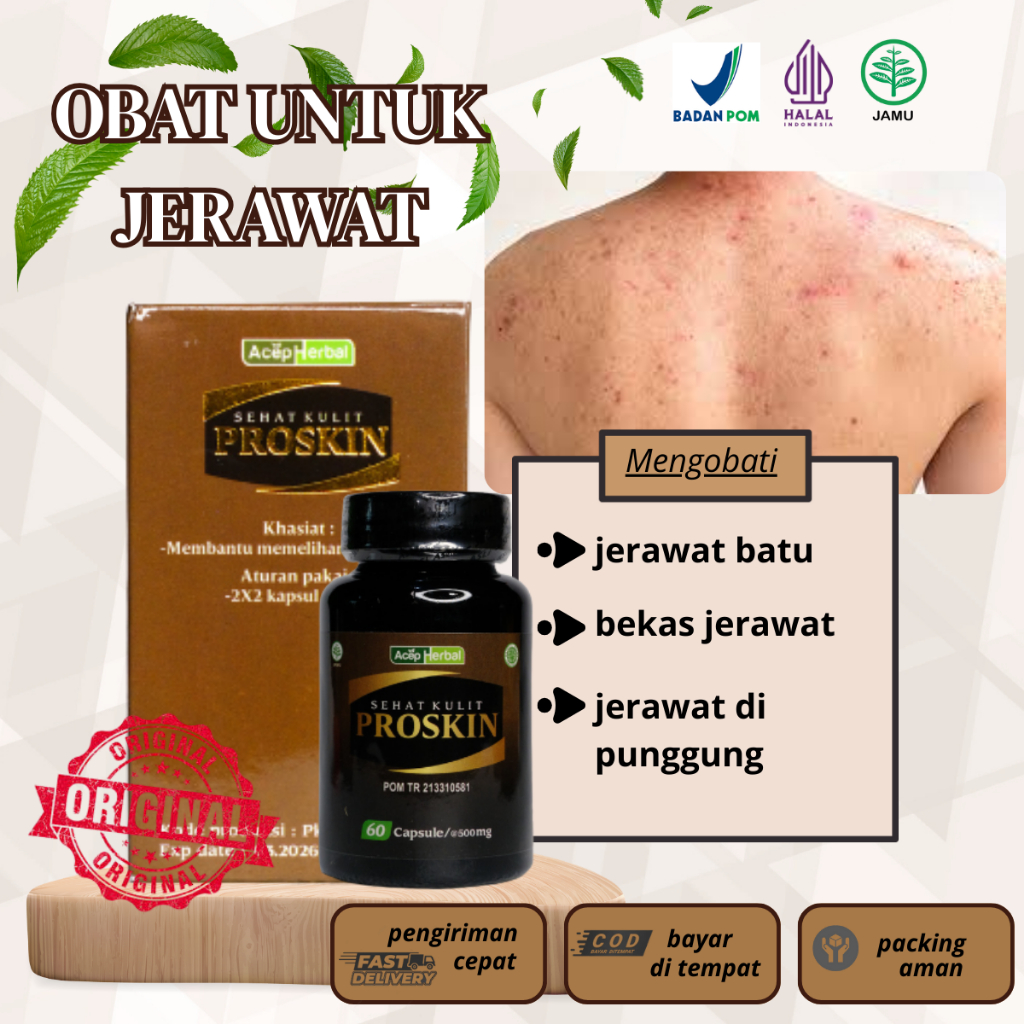 Obat minum untuk bekas jerawat, Jerawat Punggung Mendem/Meradang/Membandel, Jerawat Hormon, Jerawat 