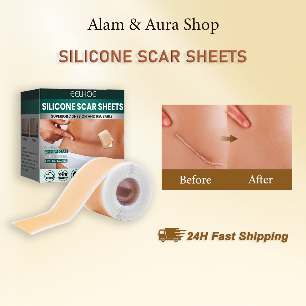 2pcs EELHOE Silicone Scar Sheets 4×150cm Dermaline Silicone Keloid Penghilang Bekas Luka Penghilang 