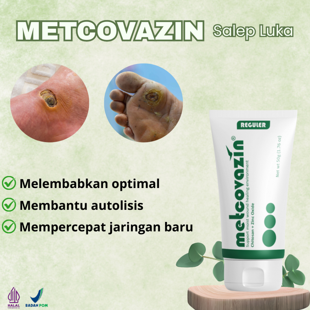 Salep Metcovazin 25gr – Obat Luka Bernanah, Luka Diabetes & Luka Basah Ampuh