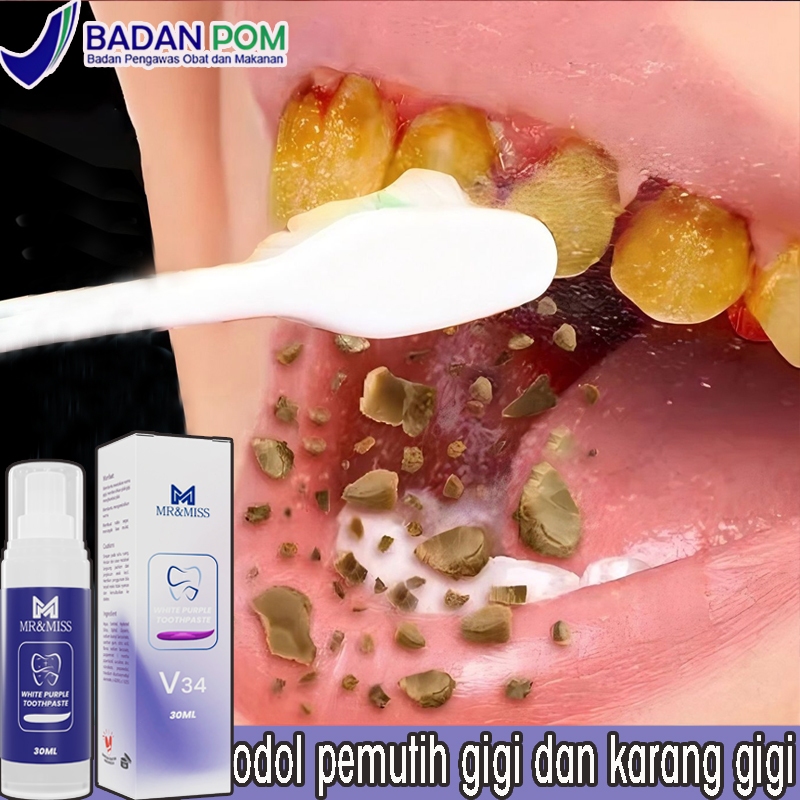Odol pemutih gigi dan karang gigi Pasta gigi pemutih Pembersih karang gigi Pembersih gigi kuning dan