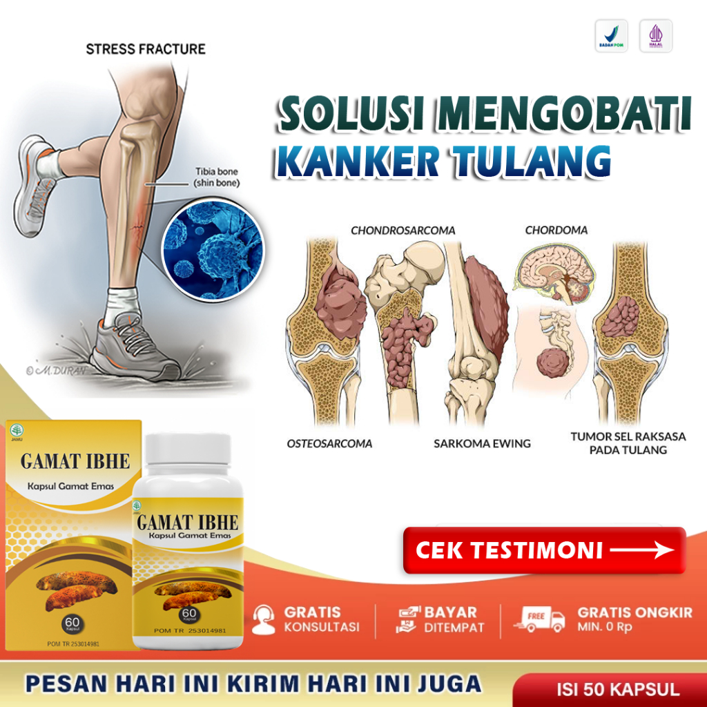 Obat Kanker Tulang Paling Ampuh Tumor Ganas Osteosarkoma Benjolan di Dalam Tulang Bengkak Cancer Sum