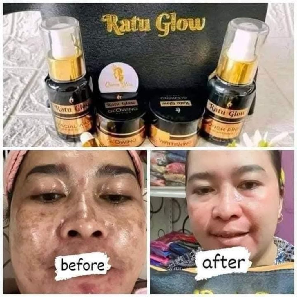 skincare platinum ratu glow