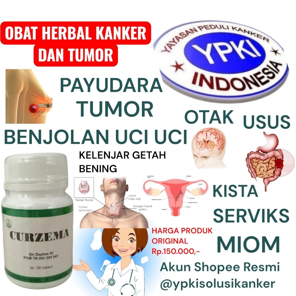 CURZEMA YPKI ll OBAT KANKER DAN TUMOR ll OBAT KANKER RAHIM ll OBAT KANKER SERVIKS ll OBAT KANKER PAY