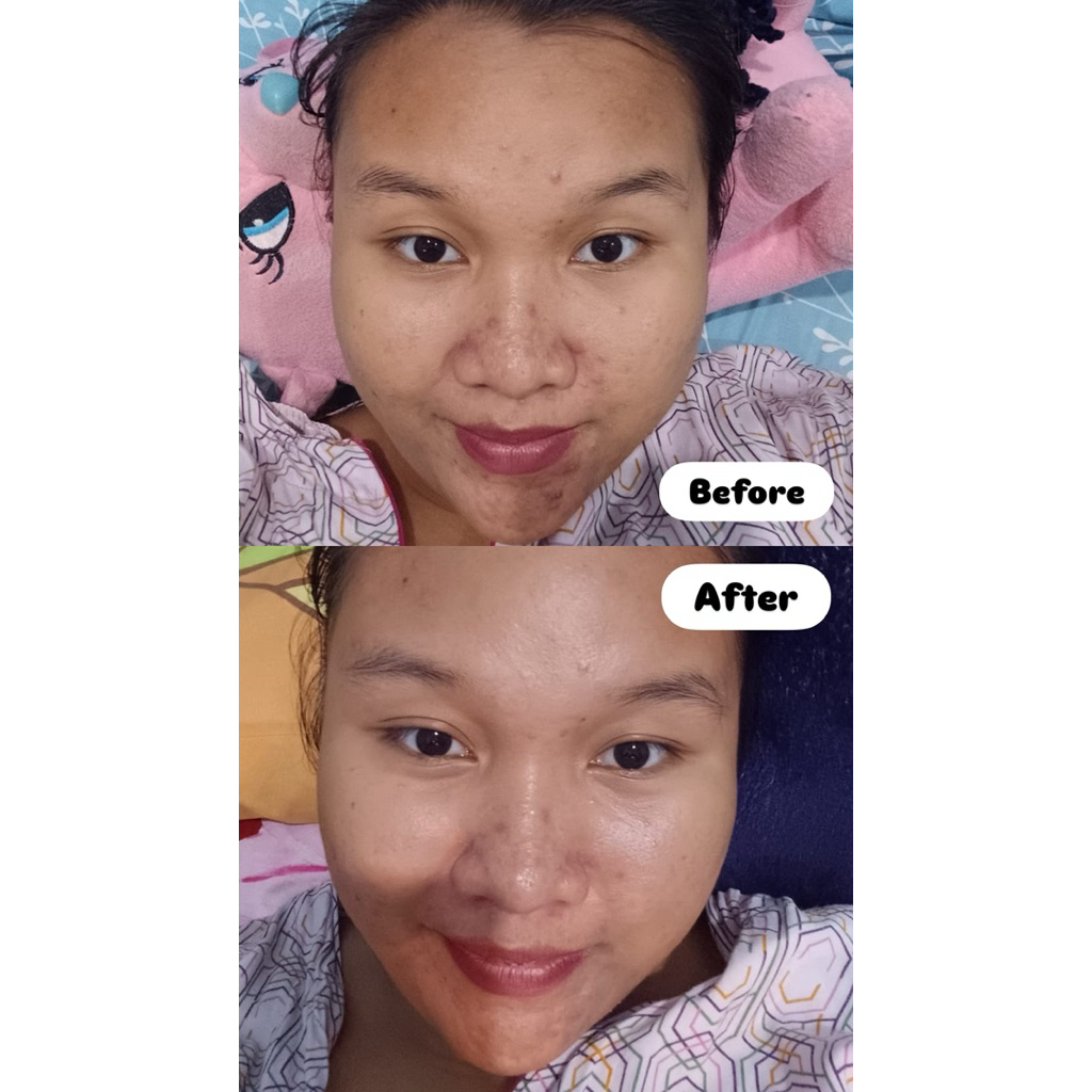 1 PAKET DS GLOW SKINCARE-PLATINUM SERIES ( Free Gift )