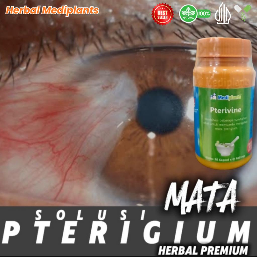Mediplants Pterivine - Obat Mata Pterigium - Herbal Lemak Mata Paling Ampuh - Original