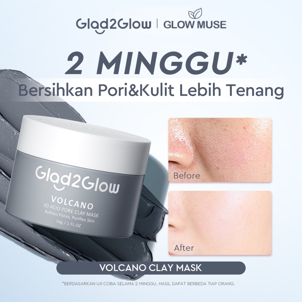 [100% Ori] Glad2Glow Volcano 3D Acid Pore Clay Mask Masker Wajah Blackhead Whitehead Masker Glad2Glo
