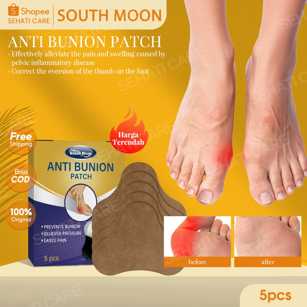 South Moon Anti Bunion Patch 5pcs Tambalan Anti-Bunion Anti-Bunion Nyeri Pembengkakan & Koreksi Posi