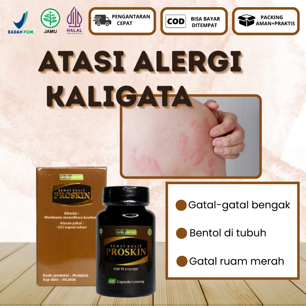 Obat Minum Untuk Atasi Kaligata, Kulit Bentol & Gatal, Gatal Akibat Alergi Kaligata-Proskin