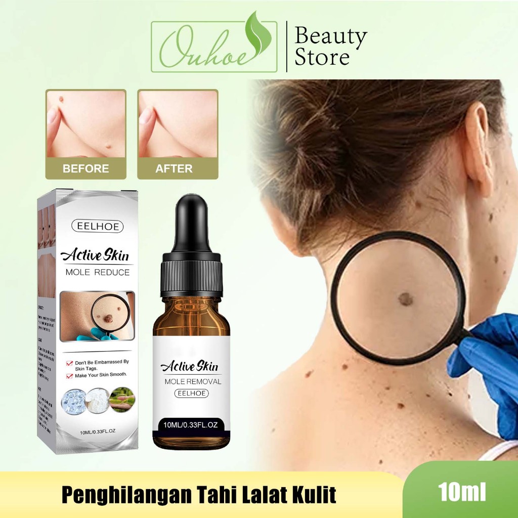 EELHOE Penghilangan Tahi Lalat Kulit 10ml - Skin Tag Remover Dark Spot /Serum Penghilang Kutil
