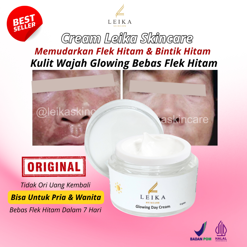 Cream flek hitam membandel krim flek hitam membandel bpom ori cream menghilangkan flek hitam di waja