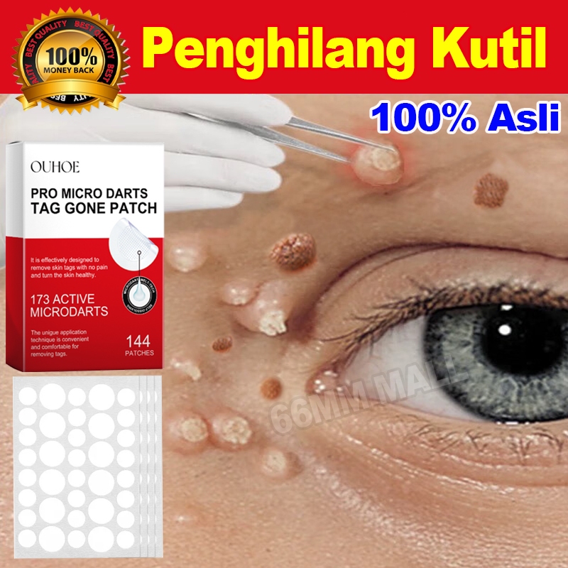 Plester Kutil Paling Ampuh 144pcs Obat Kutil Leher Sticker Penghilang Tahi Lalat dan kutil Di Wajah 