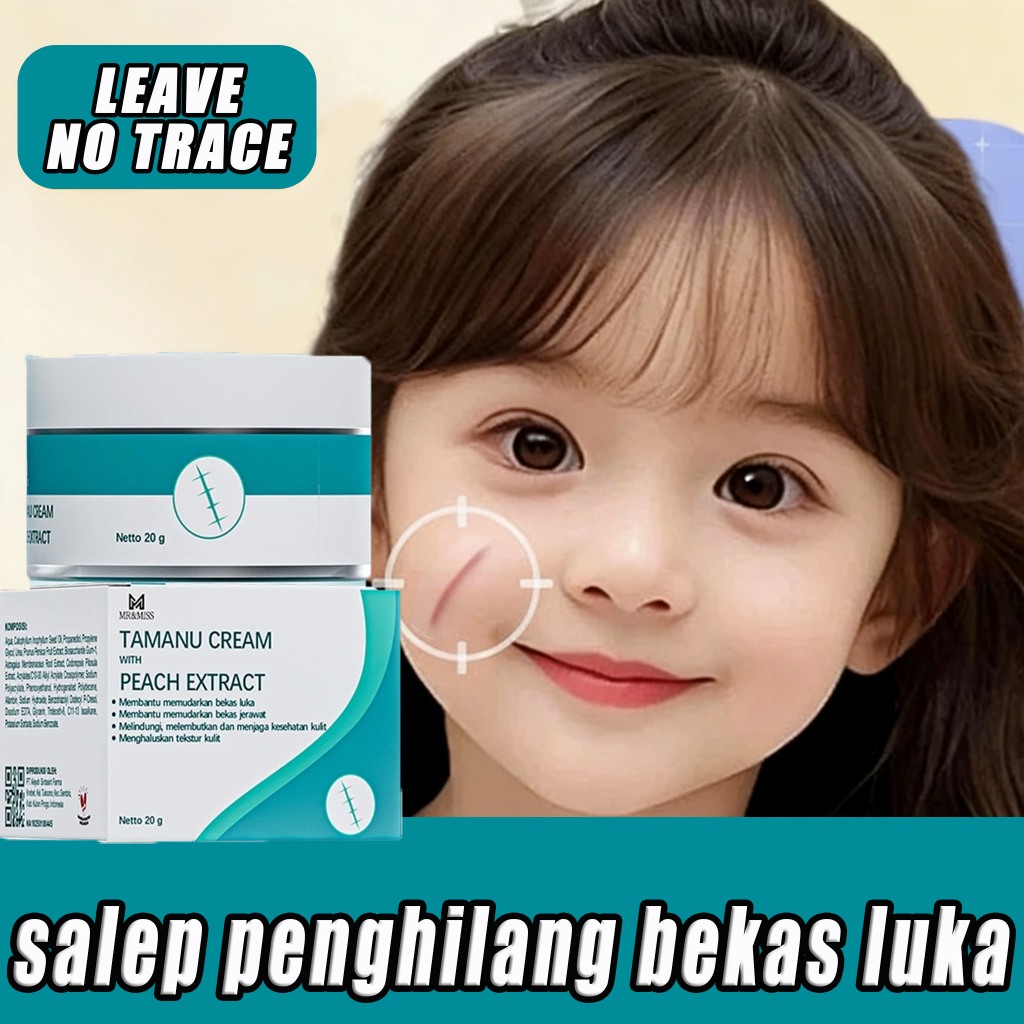 Salep luka bakar salep penghilang bekas luka penghilang bekas luka hitam koreng salep bekas luka 20g